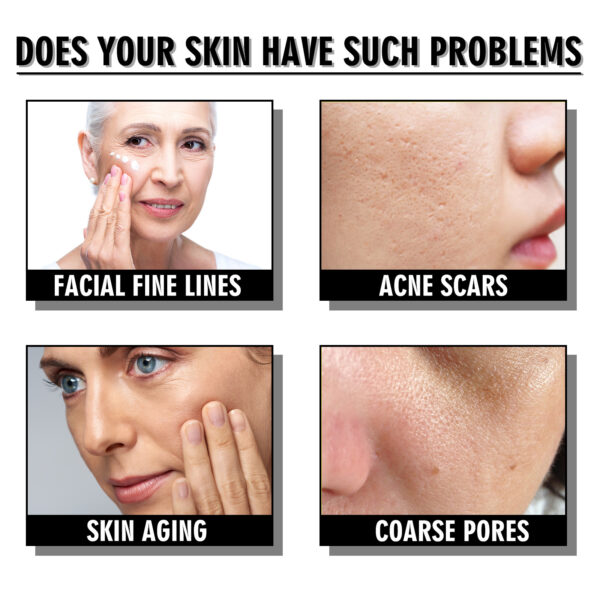 Snail Cream Fading Wrinkle French Lines Replenishment Firming Skin Anti-Aging - Image 6