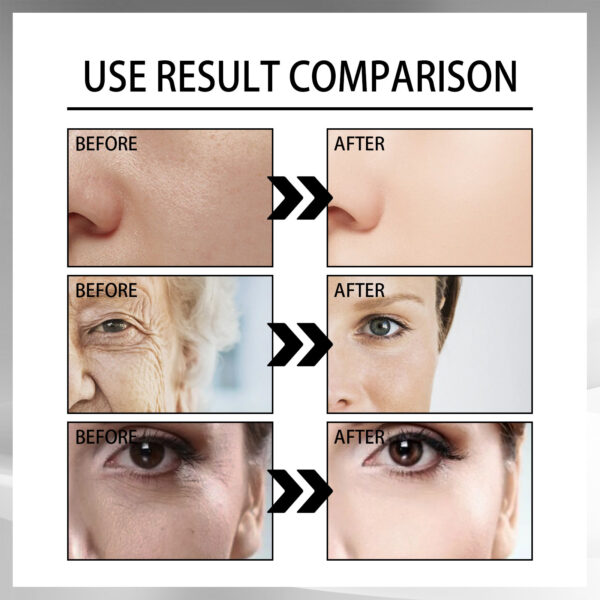 Snail Cream Fading Wrinkle French Lines Replenishment Firming Skin Anti-Aging - Image 4